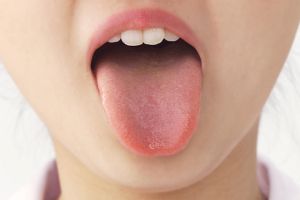 舌苔は口臭の元 除去する方法は